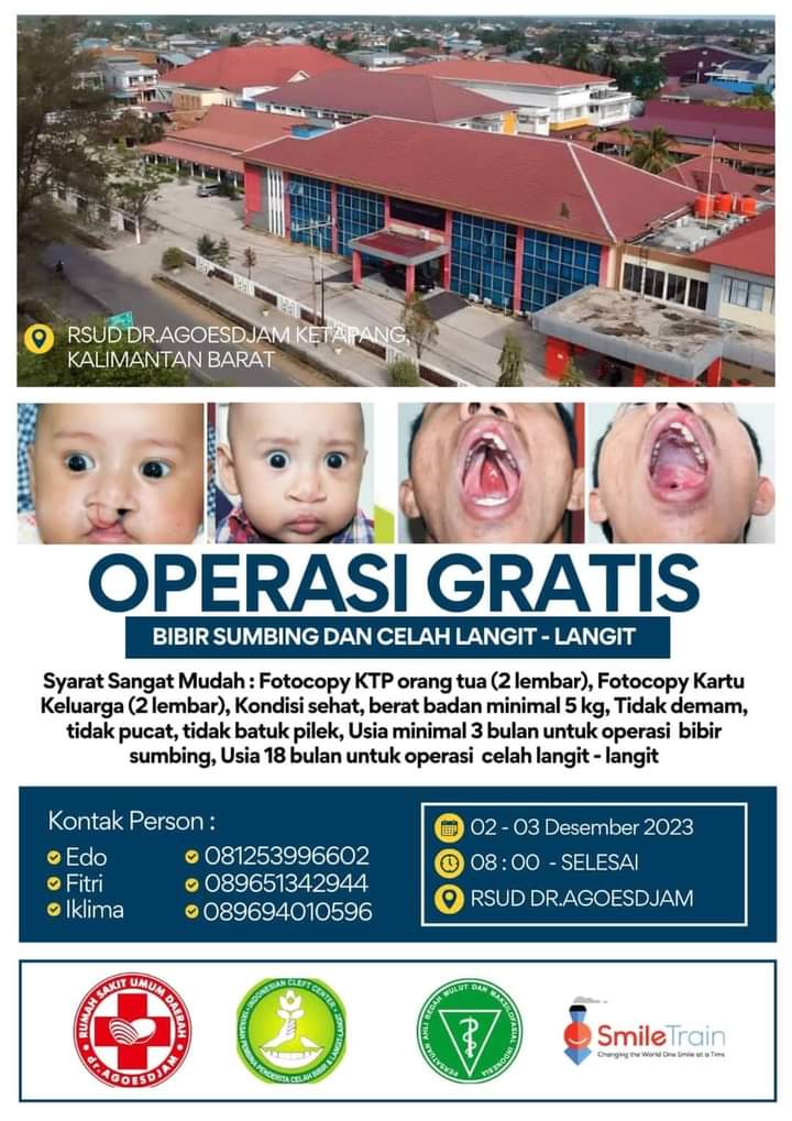 RSUD Agoesdjam Ketapang Buka Pendaftaran Operasi Bibir Sumbing Gratis