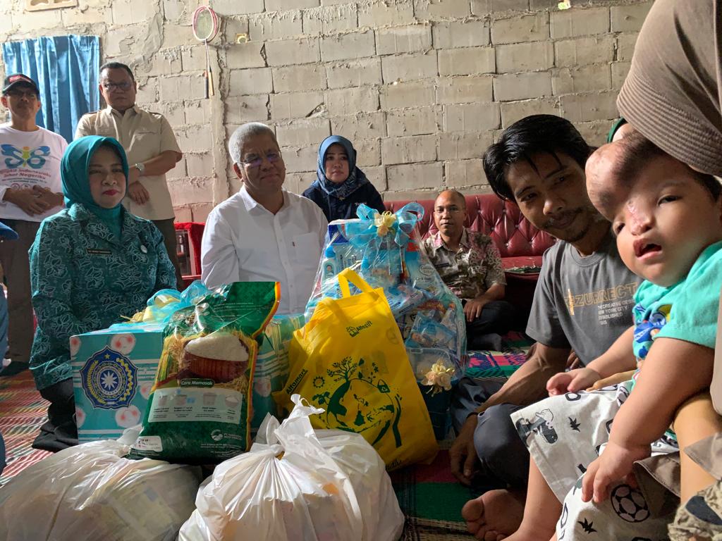 Pj Gubernur Harisson bersama Pj Ketua PKK Kalbar Kunjungi Kediaman Balita Tanpa Tempurung Kepala di Mempawah
