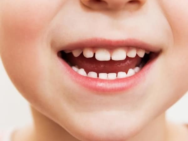 Rekomendasi Produk Pasta Gigi Berbahan Natural Untuk Anak Yang Aman