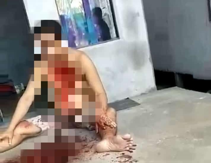 Warga MHS Ketapang Dihebohkan ODGJ Gorok Leher Sendiri Hingga Tewas