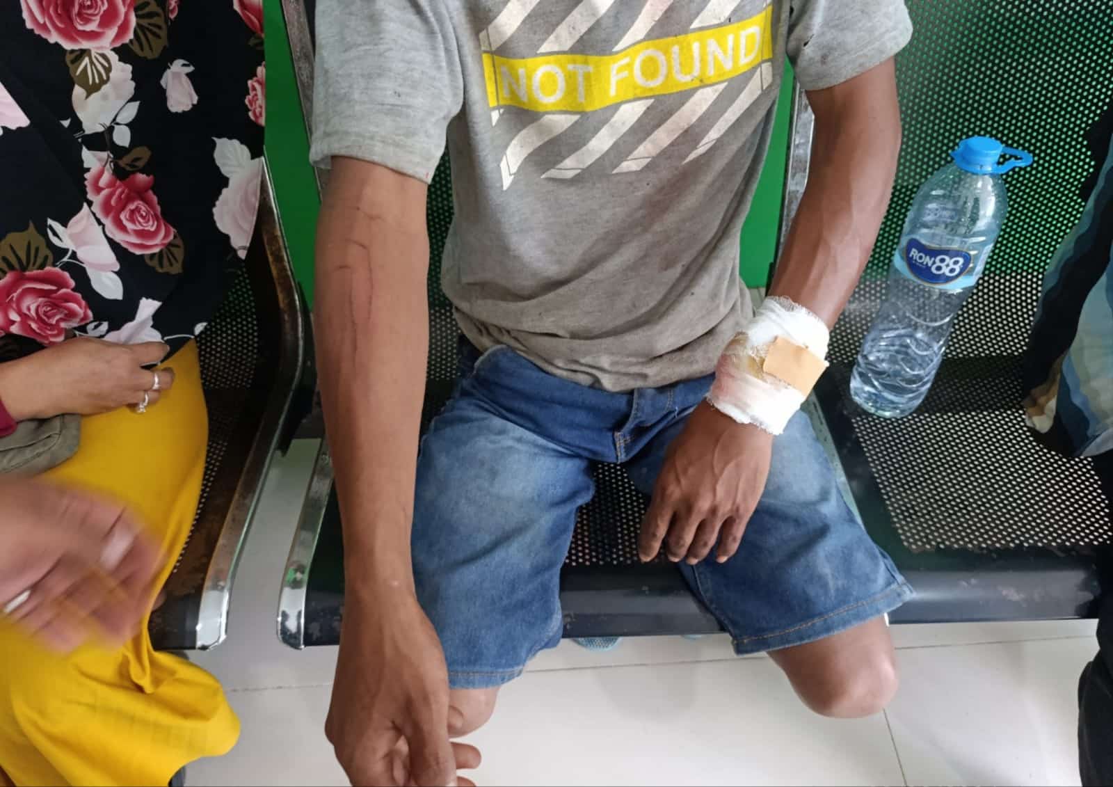 Nyaris Tewas, Buruh Bangunan Berhasil Lepas dari Cengkraman Mulut Buaya Muara