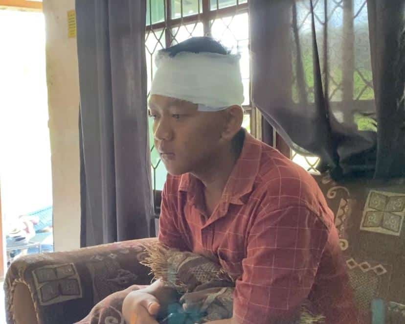 Pulang Ngopi, Remaja di Pontianak Jadi Korban Tawuran, Alami Luka Sayat di Kepala
