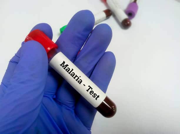 Simak Penyebab, Gejala, Pengobatan, dan Pencegahan Malaria Tropika