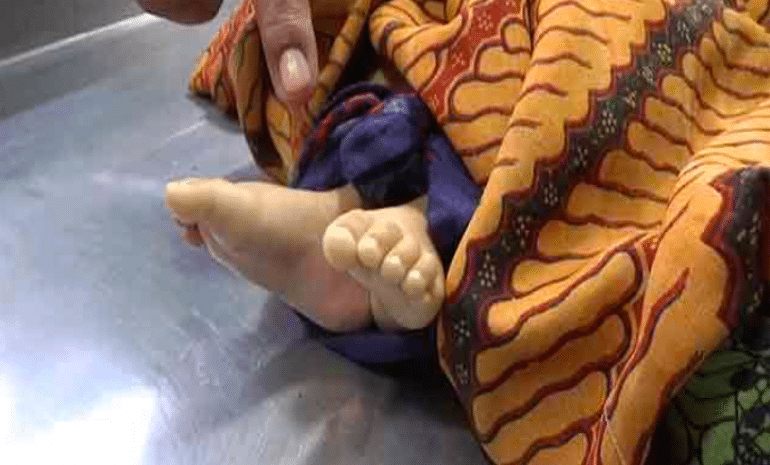 Balita Tewas Tenggelam di Kolong Rumah Saat Banjir Rob di Ketapang