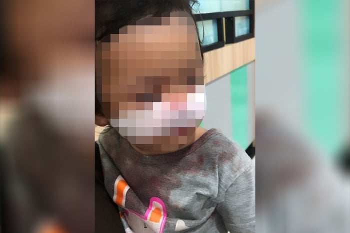 Tali Layang-Layang Lukai Balita di Pontianak, Orang Tua Tuntut Penertiban!