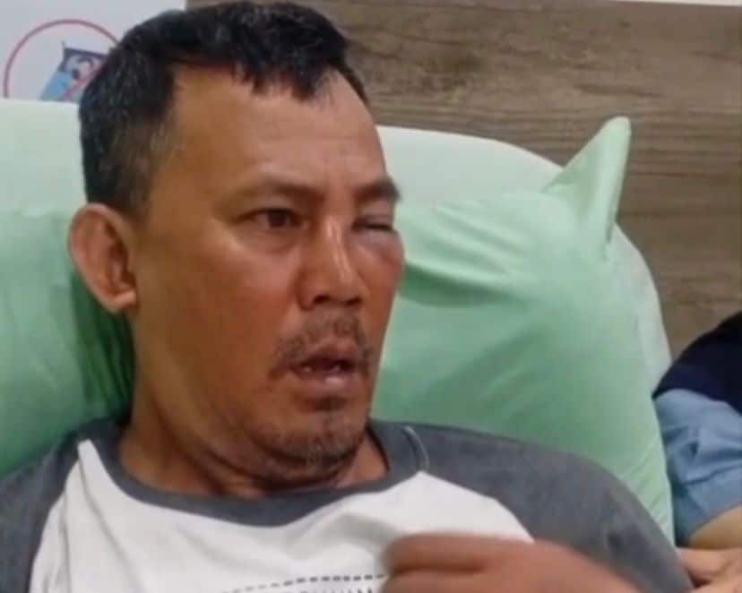 Kondisi Terkini Driver Ojol yang Dihajar Oknum TNI, Sulit Nafas Akibat Hidung Patah