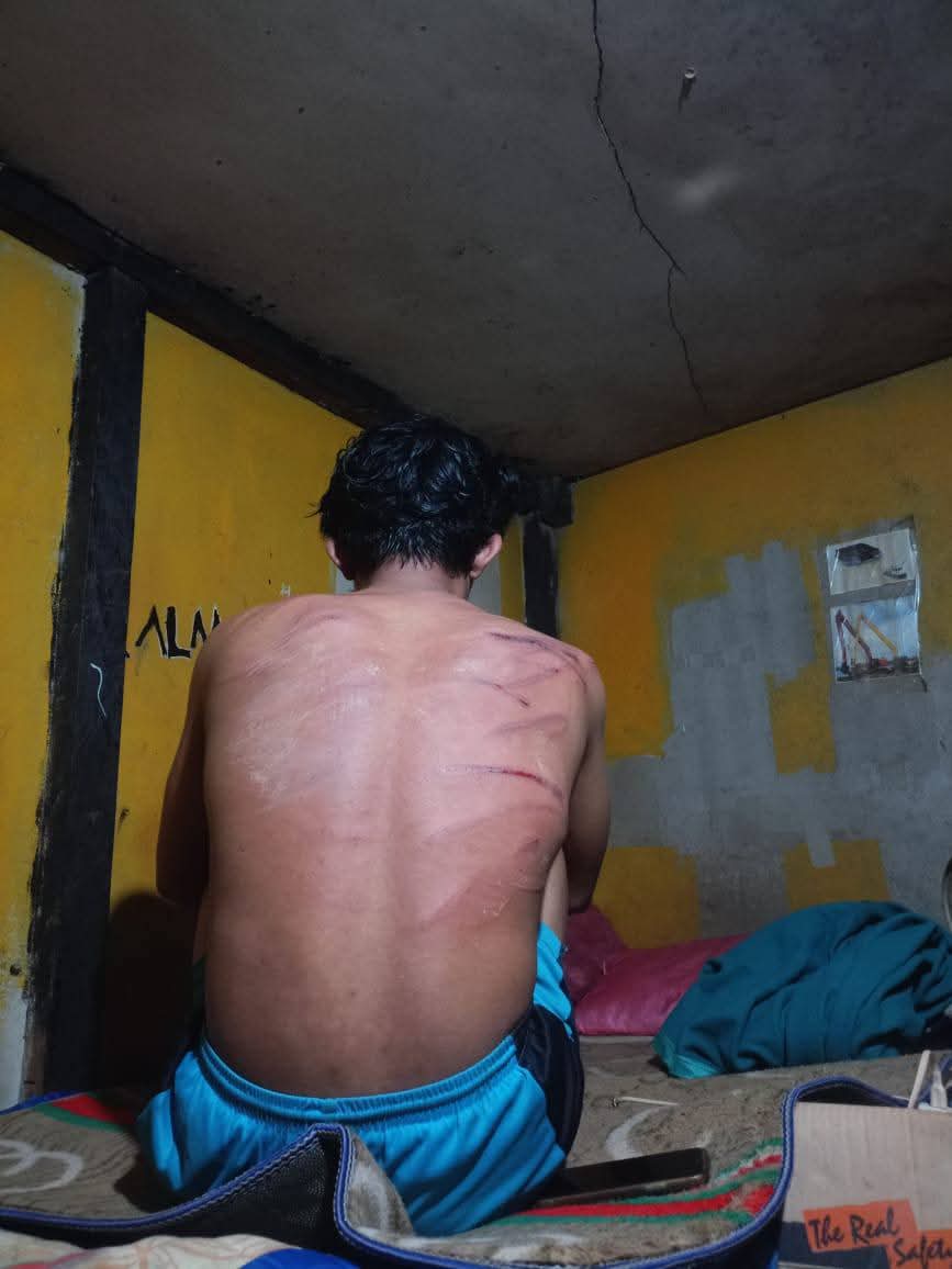 Dua Karyawan PT RIM Babak Belur Dianiaya, Pelaku Diduga Anggota BKO TNI