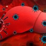 Viral Hepatitis